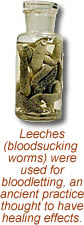 photo of leeches